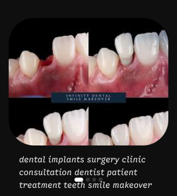 Single Dental Implants in Istanbul: Real Costs, Top Materials & What to Expect