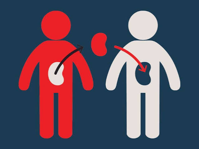 Transplant